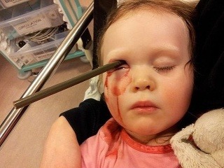 Hrôzostrašné zranenie: Dievčatku prerazila