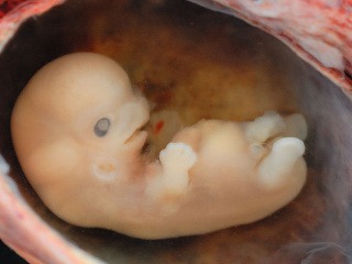 Embryá nájdené v lese