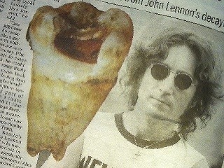 John Lennon, zub