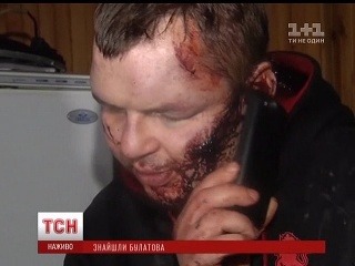 VIDEO Brutality na Ukrajine: