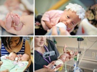Nádherné FOTO predčasne narodených