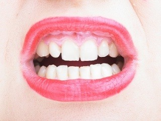 Pri nepríjemných bolestiach zubov