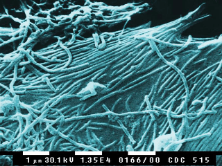 Epidémia eboly v západnej