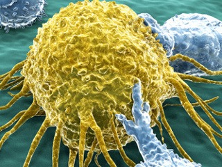 Rakovinová bunka