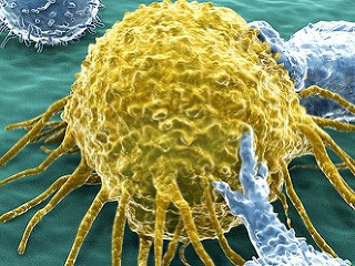 Rakovinová bunka