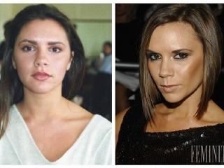 Koľko plastických operácií má