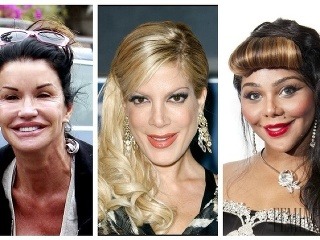 Doplatili na posadnutosť krásou: