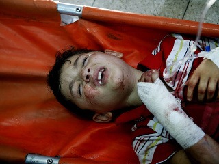 Zranené palestínske deti po