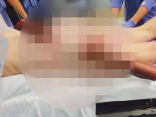 SMSkovala počas toho, ako