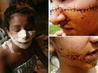 FOTO dievčenskej brutality: Juliu