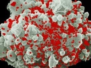 Počet HIV infikovaných na