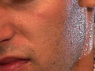 Electro Antiperspirant