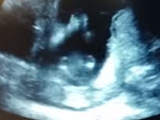 Rozkošné: Bábätko si počas