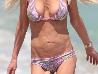 Toto telo bolo kedysi