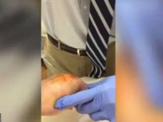 Mladíkovi niečo vyťahujú z