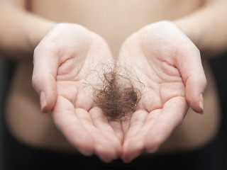 Nepodceňujte vypadávanie vlasov!