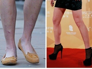 Toto sú najškaredšie nohy