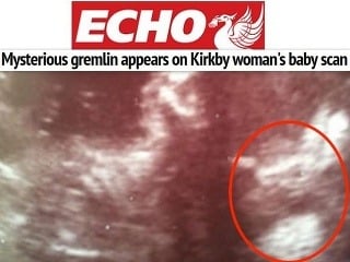 Prekvapivý úkaz na ultrazvuku: