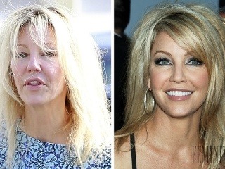 Krásnu seriálovú Amandu zmenili