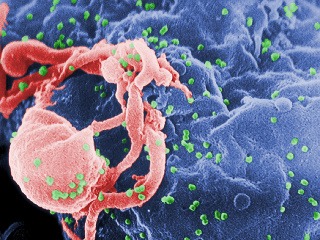 Žena nakazená HIV udivuje