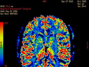 Socrates: Pozor na neplodnosť