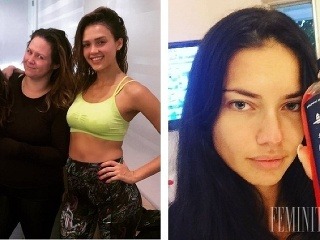 Známe tváre bez štipky