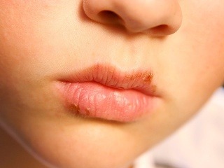 Využite čajové vrecúška, dokážu