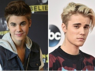 Trend peroxidových chlapcov je