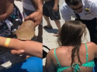 Mladú ženu pohrýzol žralok
