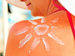 Priveľa slnka? Doprajte spálenej