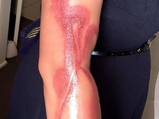 Desivé FOTO: Tehotná žena