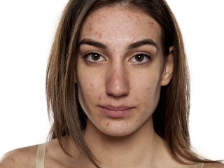 Zaujíma vás, prečo niekto