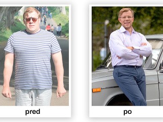 Šokujúce: Muž schudol 10