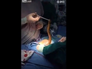 Nechutné VIDEO z nemocničnej