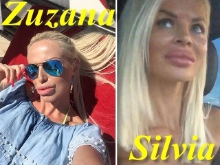 Zúfalstvo slovenskej hviezdičky: Obdivuje