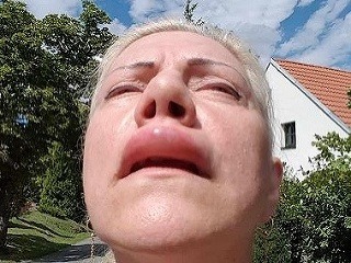 Zohyzdená tvár českej speváčky