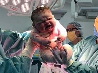 Mama v Austrálii porodila