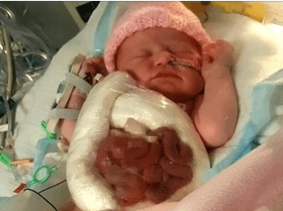 Bábätko, ktoré sa narodila