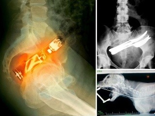 Najbizarnejšie röntgenové FOTO: Toto