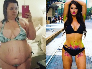 Pred a po chudnutí: