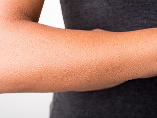 Spôsobuje vám hudba zimomriavky?