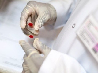 V Bratislave vyčíňa nebezpečný