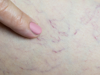 Slováci umierajú hlavne na