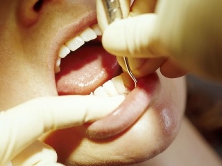 Cukrovku môže odhaliť aj