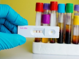 Ochorenie s mimoriadne zákerným