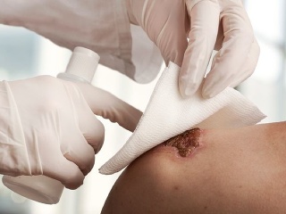 Bežné poranenie môže mať