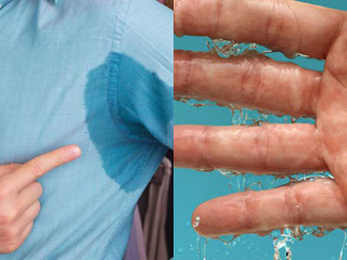 Electro Antiperspirant