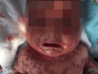 Vďaka maminým bozkom sa