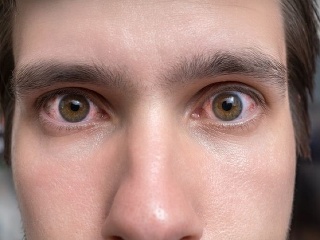 Krutý účinok stresu, o