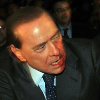 Berlusconi na klinike, útočníka